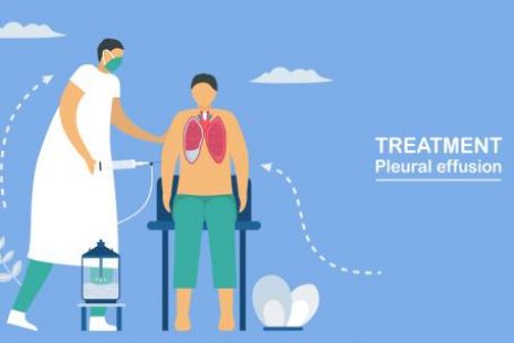 Pleuroscopy Pleuroscopy